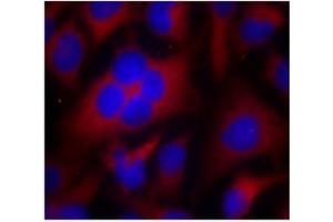 Image no. 2 for anti-Cyclin-Dependent Kinase 1 (CDK1) (Thr161) antibody (ABIN197352) (CDK1 抗体  (Thr161))