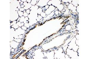 IHC-P: FGFR3 antibody testing of rat lung tissue (FGFR3 抗体  (N-Term))