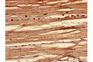 Immunohistochemistry of paraffin-embedded human skeletal muscle tissue using ABIN7152425 at dilution of 1:100 (F-Box Protein 3 抗体  (AA 276-376))