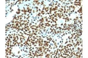 Formalin-fixed, paraffin-embedded human tonsil stained with Nuclear marker antibody (NM106). (Nuclear Marker 抗体)
