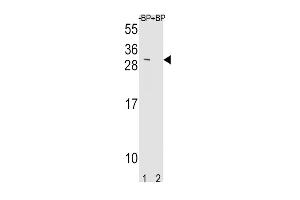 Western blot analysis of TIMP3 Antibody Pab pre-incubated without(lane 1) and with(lane 2) blocking peptide in mouse NIH-3T3 cell line lysate. (TIMP3 抗体  (AA 113-139))