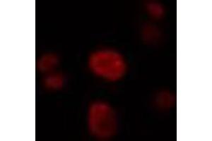 ABIN6274322 staining LOVO cells by IF/ICC. (SRSF4 抗体  (Internal Region))
