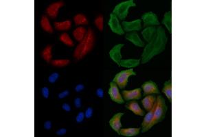 ABIN6261604 and ABIN6266802 staining Hela cells by IF/ICC. (EPS8-Like 2 抗体  (N-Term))