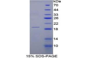 SDS-PAGE analysis of Rat RNASE3 Protein. (RNASE3 蛋白)