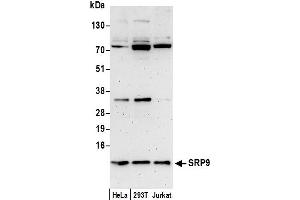 anti-Signal Recognition Particle 9kDa (SRP9) (AA 36-86) antibody