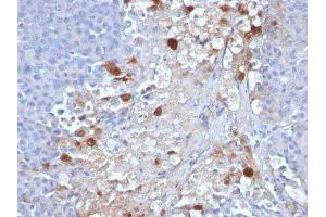 Image no. 3 for anti-Melanoma Cell Adhesion Molecule (MCAM) antibody (ABIN6153300) (MCAM 抗体)