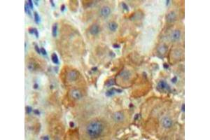IHC-P analysis of Liver tissue, with DAB staining. (F12 抗体  (AA 352-587))