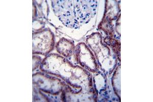 Immunohistochemistry (IHC) image for anti-General Transcription Factor IIE, Polypeptide 1, alpha 56kDa (GTF2E1) (AA 782-811), (C-Term) antibody (ABIN5538734)