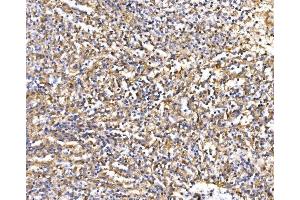 IHC analysis of Epac1/RAPGEF3 using anti-Epac1/RAPGEF3 antibody (ABIN7601858).