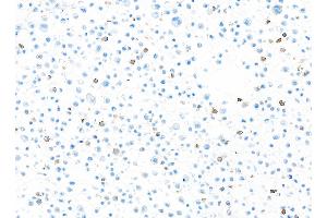 Immunocytochemistry (ICC) image for anti-Integrin, alpha E (Antigen CD103, Human Mucosal Lymphocyte Antigen 1, alpha Polypeptide) (ITGAE) (AA 400-450) antibody (ABIN7455115)