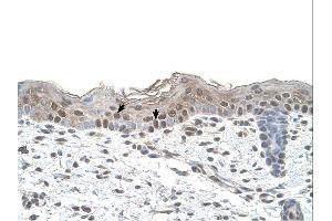 IHC Information: Human skin. (Arrestin 3 抗体  (Middle Region))