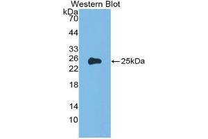 Detection of Recombinant a1AGP, Rat using Polyclonal Antibody to Alpha-1-Acid Glycoprotein (a1AGP) (ORM1 抗体  (AA 19-201))