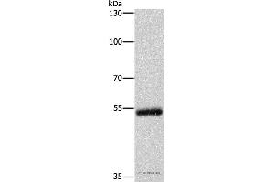 Western blot analysis of Human colon cancer tissue, using CYP2B6 Polyclonal Antibody at dilution of 1:400 (CYP2B6 抗体)
