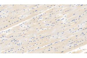 Detection of VEGF165 in Porcine Cardiac Muscle Tissue using Monoclonal Antibody to Vascular Endothelial Growth Factor 165 (VEGF165) (VEGF 165 (AA 28-191) 抗体)