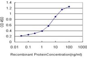 Detection limit for recombinant GST tagged ERN1 is approximately 0. (ERN1 抗体  (AA 401-500))