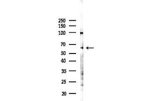 Western blot analysis of lysates from PC12 cells(LPS 4h treatment), using ABCG5 Antibody at 1/1000 dilution.