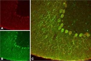 Expression of KCNK4 in rat cerebellum - Immunohistochemical staining of rat cerebellum using Anti-KCNK4 (TRAAK) Antibody (ABIN7043454, ABIN7045004 and ABIN7045005) ). (KCNK4 抗体  (C-Term, Intracellular))