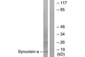 Western blot analysis of extracts from 293 cells, treated with Etoposide 25myM 60', using Synuclein-alpha (Ab-133) Antibody. (SNCA 抗体  (AA 91-140))