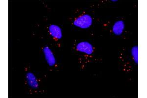 Proximity Ligation Analysis of protein-protein interactions between PRKCD and FYN. (PKC delta 抗体  (AA 1-676))