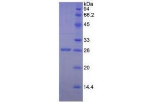 Image no. 1 for Granzyme M (Lymphocyte Met-Ase 1) (GZMM) (AA 26-257) (Active) protein (His tag) (ABIN6239817)