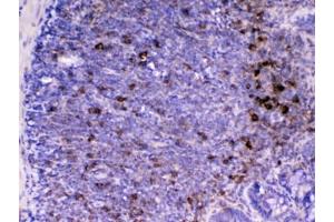 Immunohistochemistry (IHC) image for anti-CD14 (CD14) (AA 16-260) antibody (ABIN5708067)