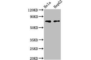 Western Blot Positive WB detected in: Hela whole cell lysate, HepG2 whole cell lysate All lanes: FRMD6 antibody at 3 μg/mL Secondary Goat polyclonal to rabbit IgG at 1/50000 dilution Predicted band size: 73, 71, 30 kDa Observed band size: 73 kDa (FRMD6 抗体  (AA 413-622))