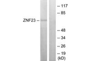 Western blot analysis of extracts from LOVO cells, using ZNF23 Antibody. (ZNF23 抗体  (AA 151-200))