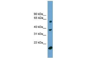 WB Suggested Anti-TBL1Y Antibody Titration:  0. (TBL1Y 抗体  (Middle Region))
