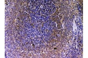 IHC testing of FFPE rat spleen tissue with VEGFB antibody at 1ug/ml. (VEGFB (VEGF2) 抗体)