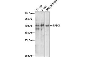 Western blot analysis of extracts of various cell lines, using NPRL2 antibody (ABIN6132809, ABIN6144787, ABIN6144788 and ABIN6221564) at 1:1000 dilution. (NPRL2 抗体  (AA 1-220))
