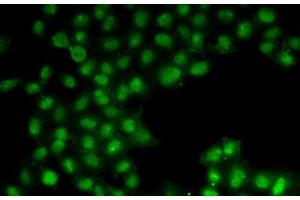Immunofluorescence analysis of U2OS cells using C11orf30 Polyclonal Antibody (EMSY 抗体)