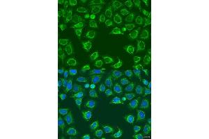Immunofluorescence analysis of U2OS cells using  antibody (ABIN7265695) at dilution of 1:100. (ALG2 抗体  (AA 197-416))
