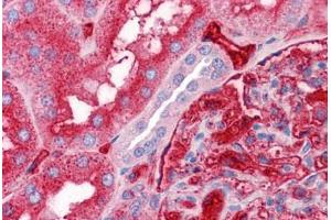 Human Kidney: Formalin-Fixed, Paraffin-Embedded (FFPE) (APOA2 抗体  (AA 1-100))