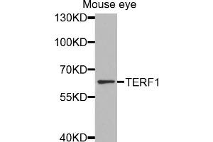 Western blot analysis of extracts of mouse eye, using TERF1 antibody (ABIN5970015) at 1/1000 dilution. (TRF1 抗体)