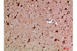 Immunohistochemistry (IHC) image for anti-Mannose-Binding Lectin (Protein C) 2, Soluble (MBL2) (AA 21-70) antibody (ABIN7189465)