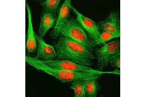 IF analysis of SPRED2 using anti-SPRED2 antibody (ABIN7601643) and anti-Tubulin Alpha antibody (ABIN7600339). (SPRED2 抗体  (AA 40-298))