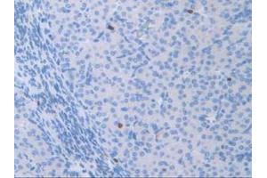 IHC-P analysis of Mouse Ovary Tissue, with DAB staining. (ATF6 抗体  (AA 1-377))