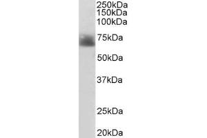 Western Blotting (WB) image for anti-Solute Carrier Family 6 (Neurotransmitter Transporter, serotonin), Member 4 (SLC6A4) (Internal Region) antibody (ABIN185394)