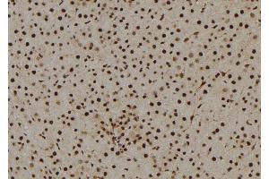 ABIN6269146 at 1/100 staining Rat liver tissue by IHC-P. (Cyclin B1 抗体  (Internal Region))