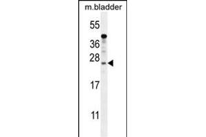 KI Antibody (N-term) (ABIN654385 and ABIN2844131) western blot analysis in mouse bladder tissue lysates (35 μg/lane). (SHISAL1/KIAA1644 抗体  (N-Term))