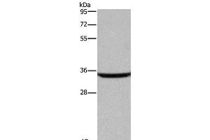 Western Blot analysis of Human fetal brain tissue using DKK3 Polyclonal Antibody at dilution of 1:200 (DKK3 抗体)
