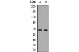 Western blot analysis of Tyrosyl-tRNA Synthetase expression in Hela (A), U87MG (B) whole cell lysates. (YARS 抗体  (C-Term))