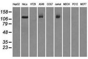 Image no. 2 for anti-Budding Uninhibited By Benzimidazoles 1 Homolog beta (Yeast) (BUB1B) antibody (ABIN1496996) (BUB1B 抗体)