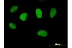 Immunofluorescence of purified MaxPab antibody to FBXO11 on HeLa cell. (FBXO11 抗体  (AA 1-843))