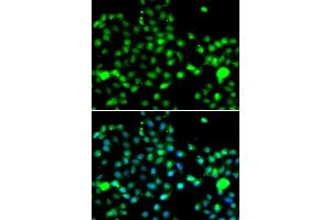 Immunofluorescence analysis of A549 cells using IP6K2 antibody. (IP6K2 抗体)