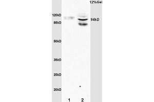 L1 rat brain lysates L2 rat liver lysates probed with Anti Phospho-STAT6(Tyr641) Polyclonal Antibody, Unconjugated (1791R) at 1:200 overnight at 4 °C. (STAT6 抗体  (pTyr641))