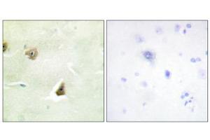 Immunohistochemistry analysis of paraffin-embedded human brain tissue, using DUSP6 antibody. (DUSP6 抗体  (Internal Region))