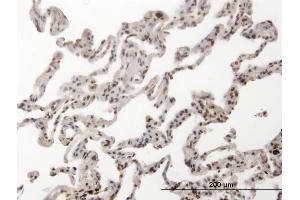 Immunoperoxidase of monoclonal antibody to HMG2L1 on formalin-fixed paraffin-embedded human lung. (HMGXB4 抗体  (AA 1-74))