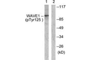 Western blot analysis of extracts from NIH-3T3 cells treated with Insulin 0. (WASF1 抗体  (pTyr125))