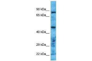Host: Rabbit Target Name: TMPRSS11B Sample Type: Hela Whole Cell lysates Antibody Dilution: 1. (TMPRSS11B 抗体  (N-Term))